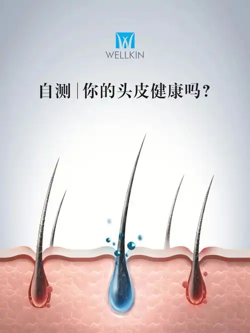 头皮健康自测