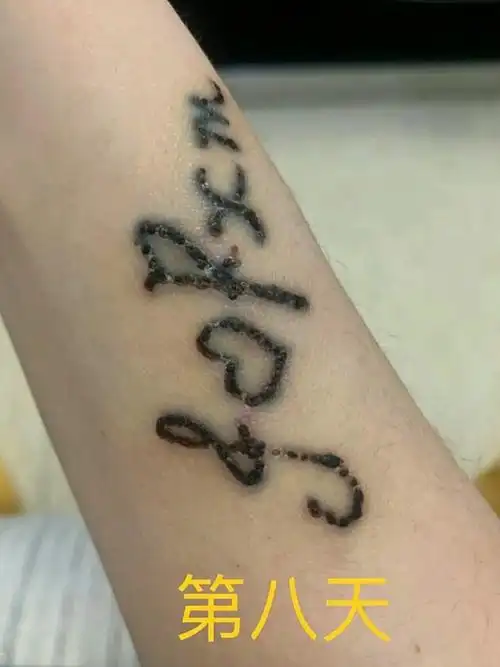 记录洗纹身恢复期第四天——第九天!