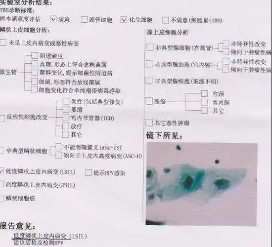 宫颈癌筛查tct报告的主要项目和内容有:(1)标本满意度:"满意"表示标本