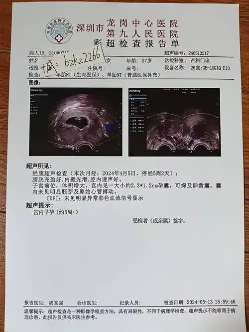 怀孕了,教你如何看懂b超单,上面有什么信息?