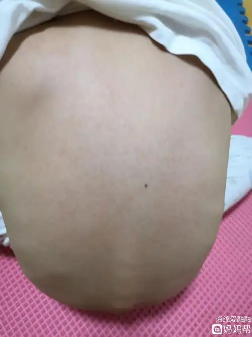 技术好!幼儿急疹的症状"得意洋洋"-第1张图片-南瑞博客