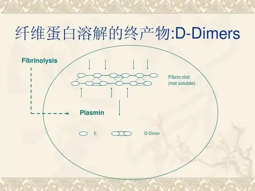 d二聚体(fdps)检测在排除vte诊断中的价值ppt