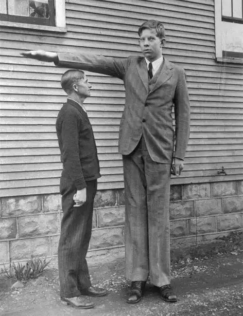 世界上最高的人,22岁长到2米72,死后被装入半吨重的水泥棺