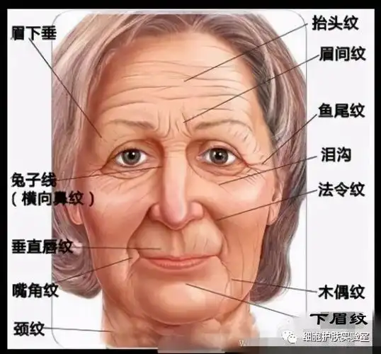 如何让川字纹躺平?_肉毒素除皱_肉毒素除皱治疗介绍 - 好大夫在线