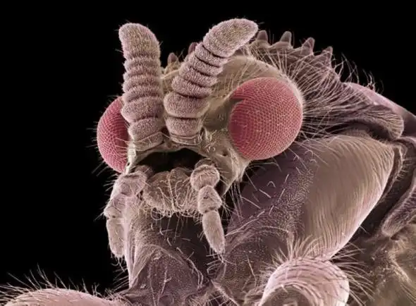 显微镜下的虫子世界