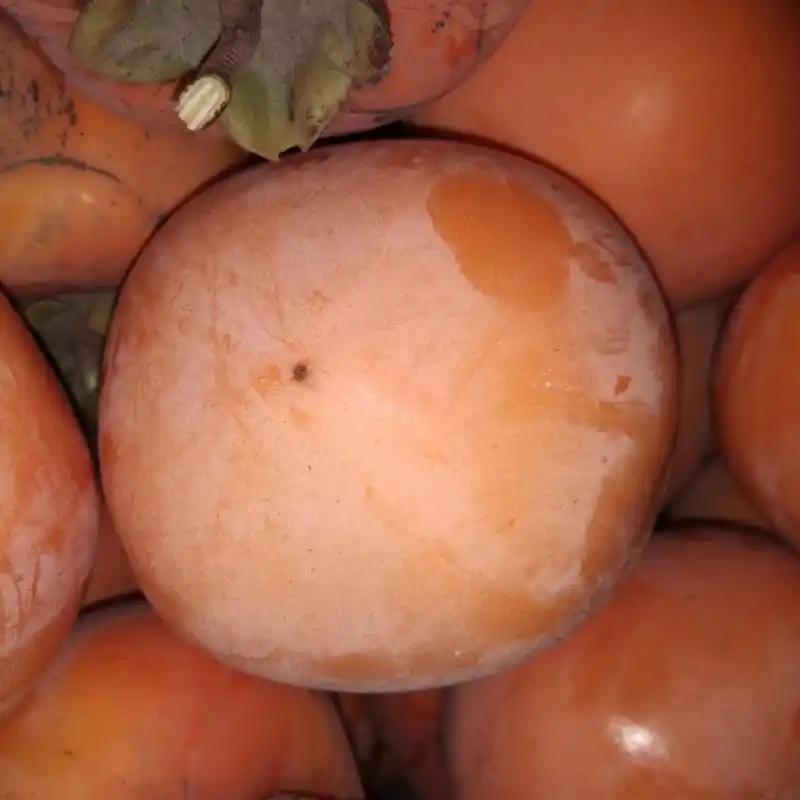 第九十五天跑步,有人问我脂肪瘤如何去除,随着生活条件的变好.