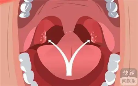 病变的进程中,每一个患者本身的体质遭到性病病毒的入侵和感染以后