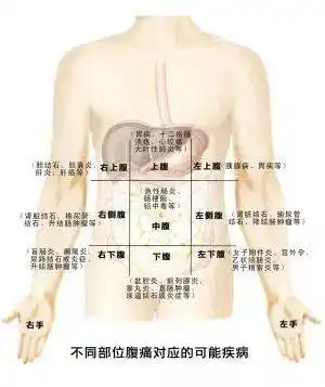 如转移性右下腹痛为急性阑尾炎典型腹痛类型,右上腹的疼痛常