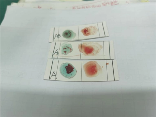 眉山一中开展生物拓展实验—血型的测定