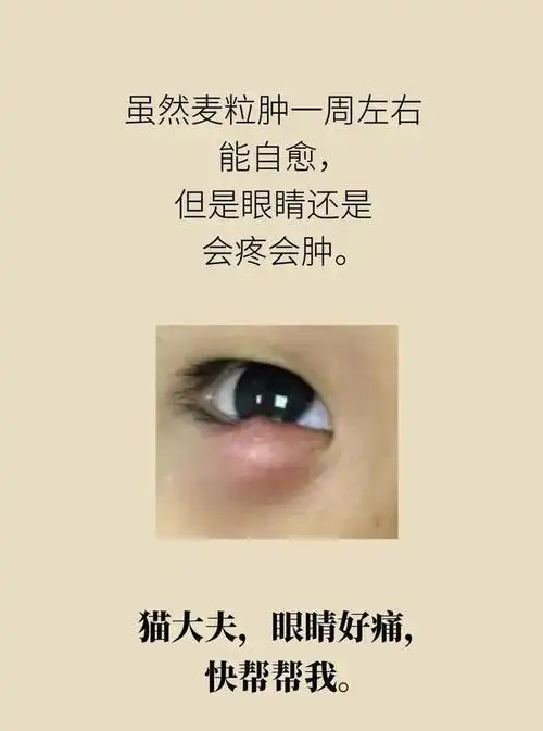 为什么有的人眼睛上会长针眼一组漫画告诉你需要怎么解决