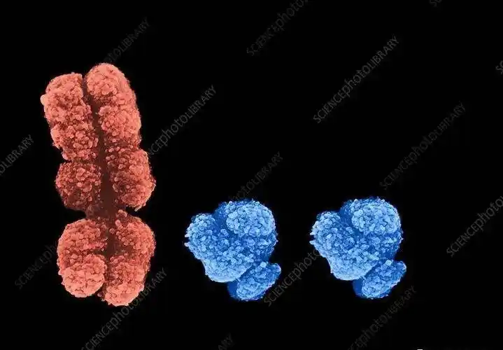 xyy综合征-一种很"男人"的病_染色体_时尚_精子