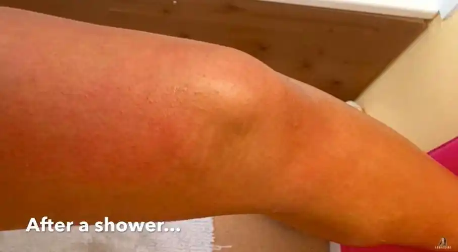 过敏症研究基金会的创始人说