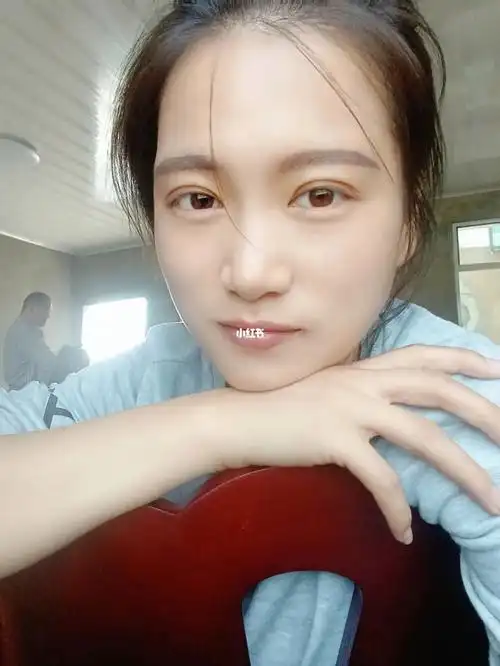 做双眼皮会后悔吗