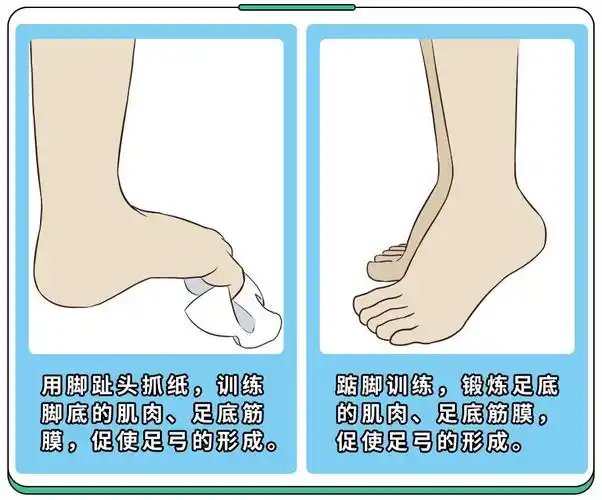 孩子扁平足伴随这几种异常必须就医