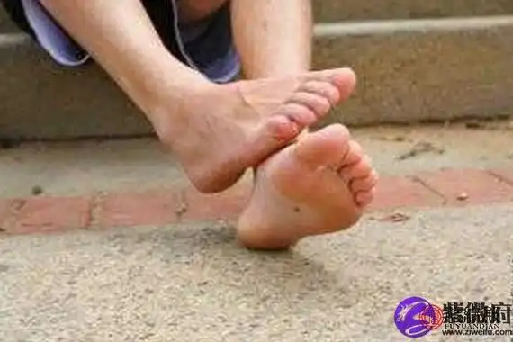 男人左脚底有痣全图解大全 痣相分析