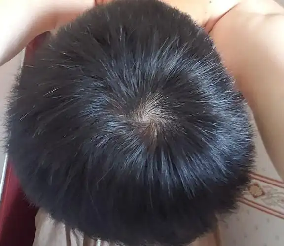 多头旋的孩子脾气坏聪明有财气头旋的真正寓意到底是啥