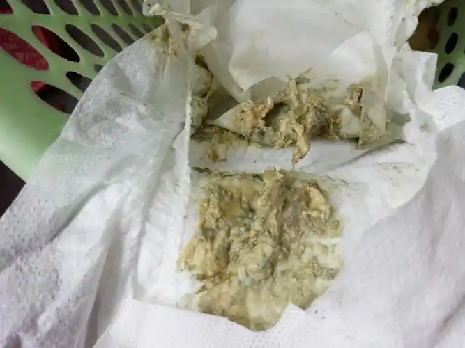 我家宝贝拉灰白色粑粑怎么回事啊