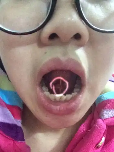 舌头下面长了块肉,弄他的时候疼呢,这是什么啊要不要紧阿