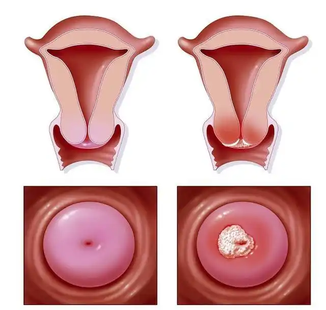 子宫是胎儿的"房间",女性子宫构造是什么样的,你清楚吗?