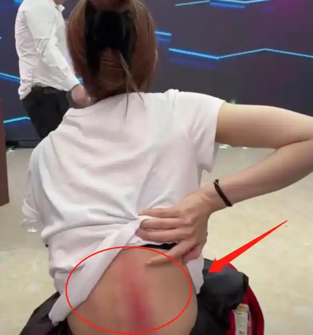 网红桐桐哭诉被家暴!后背淤青红痕刺眼,疑因外籍老公欠债闹离婚