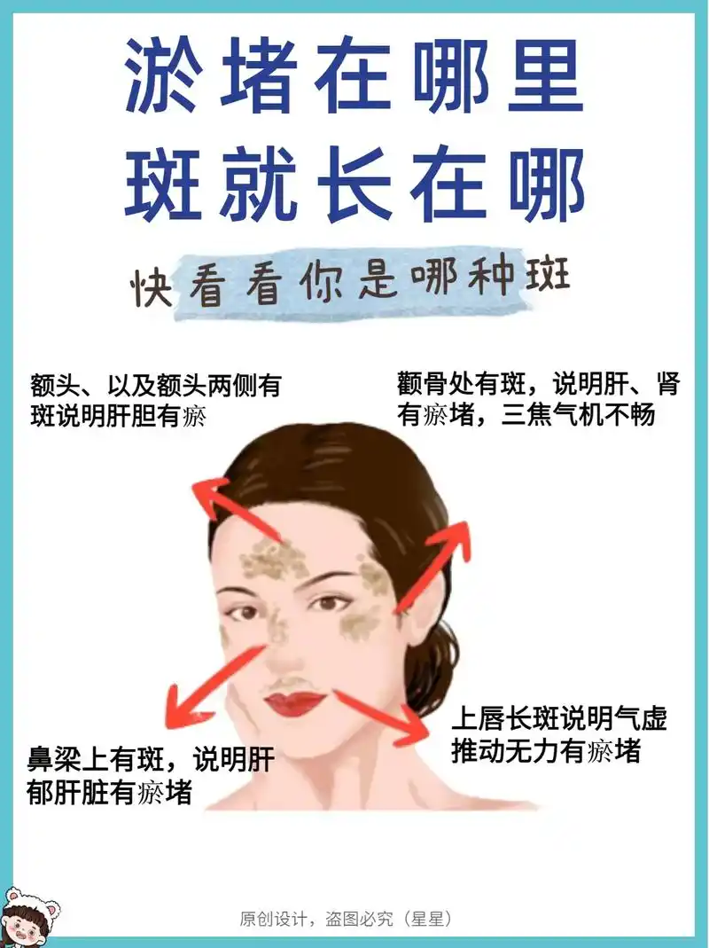 脸上的斑02对应内在的淤堵05姐妹快来看.