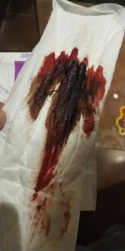 大姨妈这个颜色正常吗?4.15号来的,30号又来了