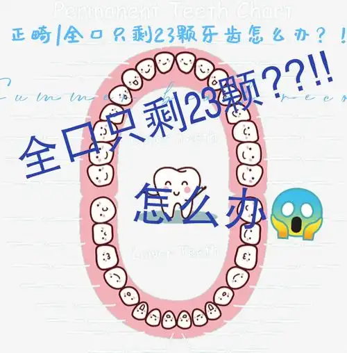 30岁正畸|全口只剩23颗牙齿怎么办05