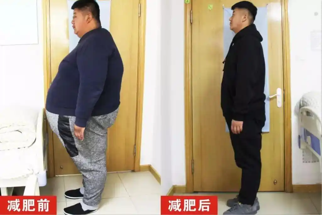 辽宁都市频道《新闻正前方》跟踪报道:420斤巨胖减肥近一年,瘦到195斤