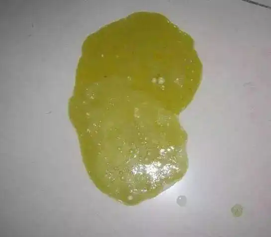 这种呕吐物基本 就是胆汁, 其实也不需要太多的关注, 但是 并不是说就