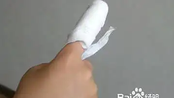 医生包扎受伤的手指,图片来自百度