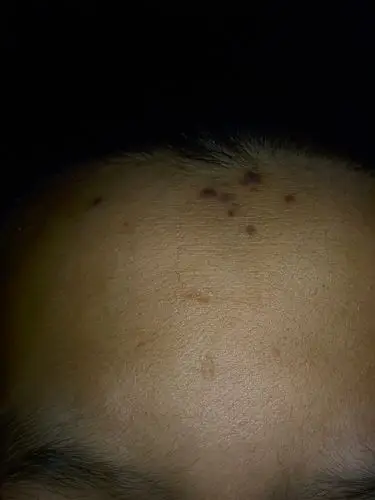 额头上长黑色突起物扣掉了不久又长起来逐渐增多发病史4个