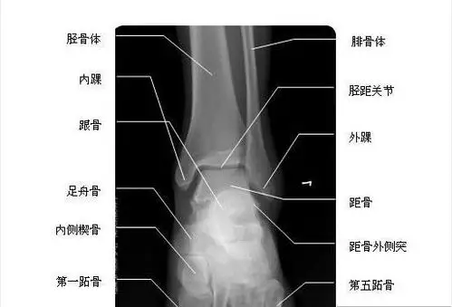 aofas2016与脚踝术后身体机能下降相关因素研究