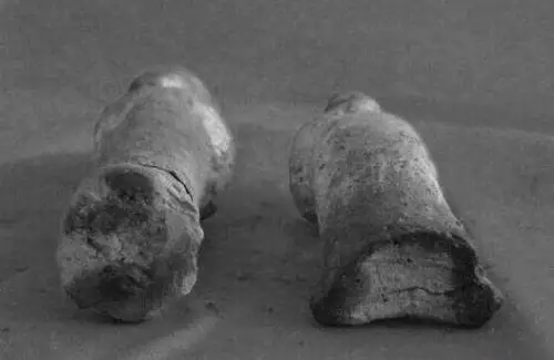 太监净身过程图解太监净身视频曝光看着蛋疼3