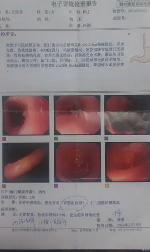 食道,十二指肠粘膜隆起,判断性质