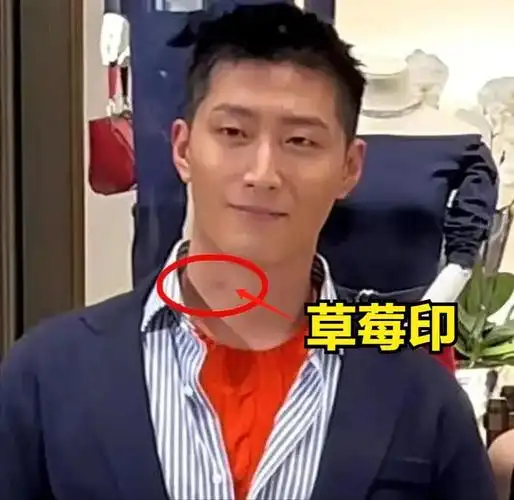 窦骁何超莲合体脖子上草莓印抢镜穿着被吐槽赵四附体太油腻