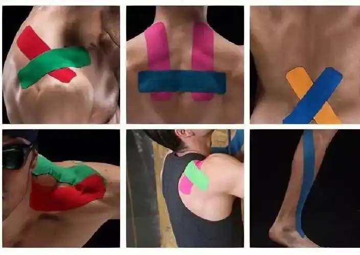 及扁平足者,过度跑步时容易出现炎症;从膝盖外下侧沿大腿外侧向上贴扎