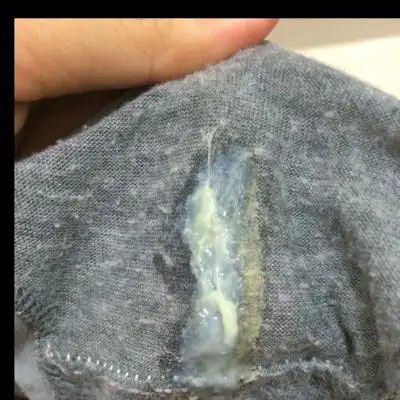 怀孕33周,每天内裤都这麼脏是什麼情况……有图慎进