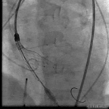 360_360gif 动态图 动图