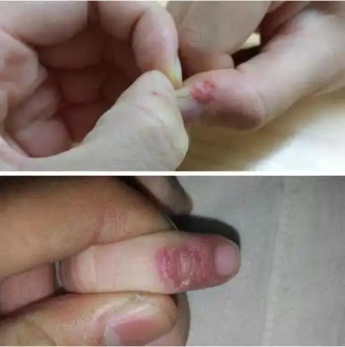 孩子抠手指是缺微量元素吗?不一定!真实原因让你心酸