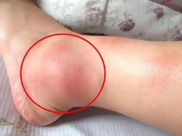 蚊子最大的天敌竟然不是蚊香只需5分钟蚊子消失不见了