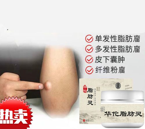 华佗脂肪瘤硬块皮下脂肪瘤消散肉瘤神器脂肪 如图 单盒