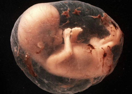 胎动是胎儿正常的生理活动,一般在孕18-20周时孕妇就可以感觉到胎儿的