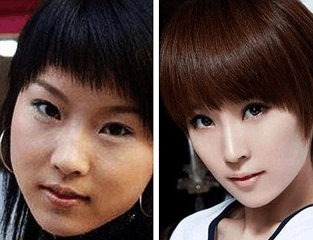 娱乐圈女明星大饼脸惊变锥子