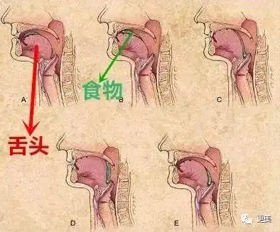 杯水或者咽吐沫试一下,感受自己吞咽时的状态,你的舌头是否顶住了上颚