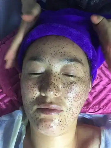 祛斑加盟奇颜玉静西北总部