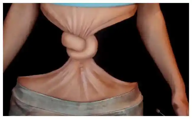 网友与女子视频看到女子的肚子肠子打成蝴蝶结捂紧嘴巴