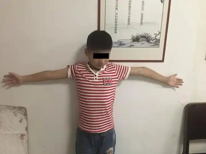 胳膊肘往里拐孩子这种情况不容忽视