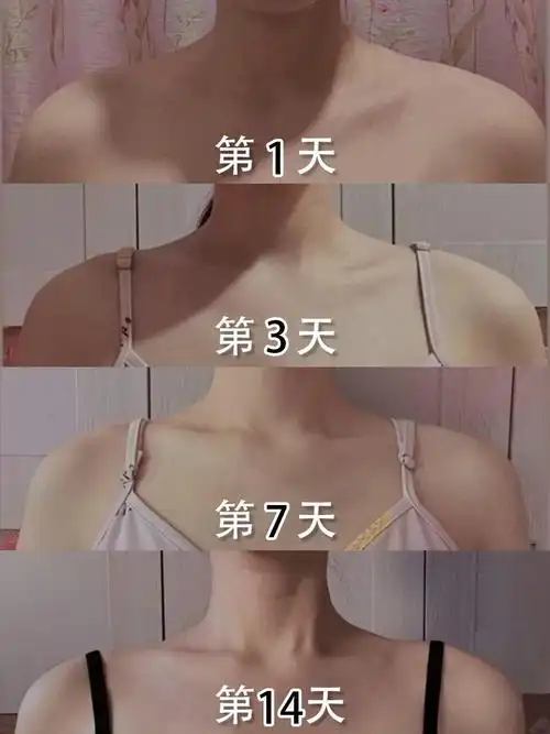 5个动作提升气质心养成直角肩改善斜方肌心