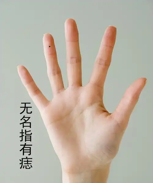 手上长痣是好是坏,都有什么寓意