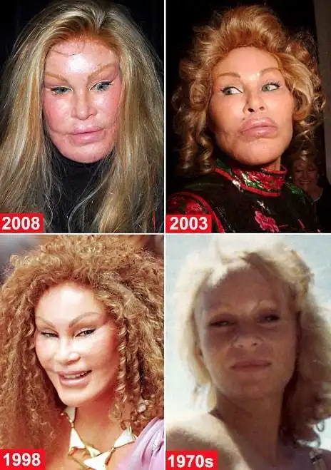 令人唏嘘看看这些整容失败的明星人工智能对比自然老去的样子